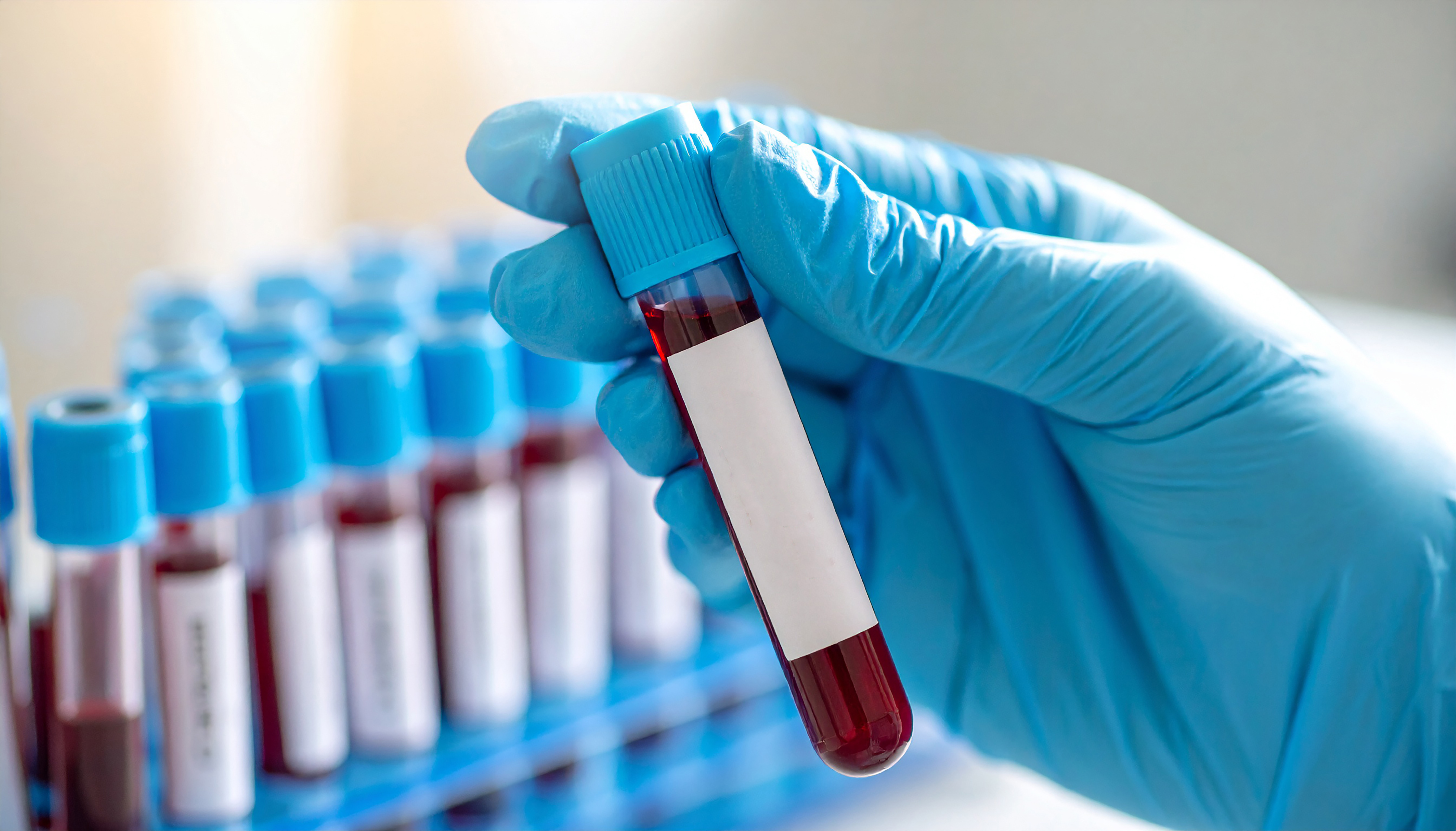 a gloved hand holding a vial of red liquid